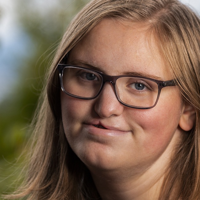 Young woman with cleft palate and  lip