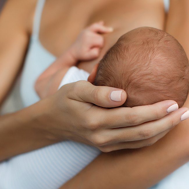 Infant with cleft lip and palate having difficulty breastfeeding