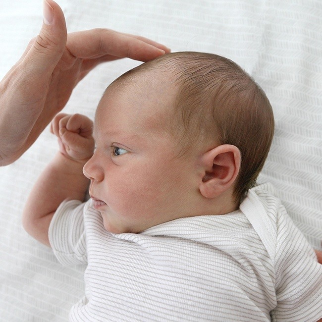 Doctor examining baby with cleft lip and palate