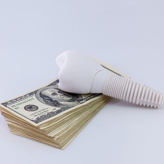 Model implant and money stack representing the cost of dental implants