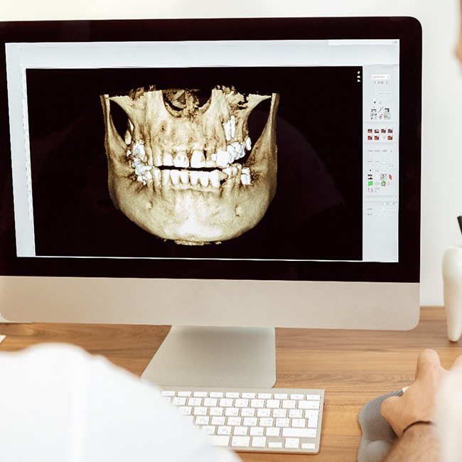 X-ray of mouth on computer screen