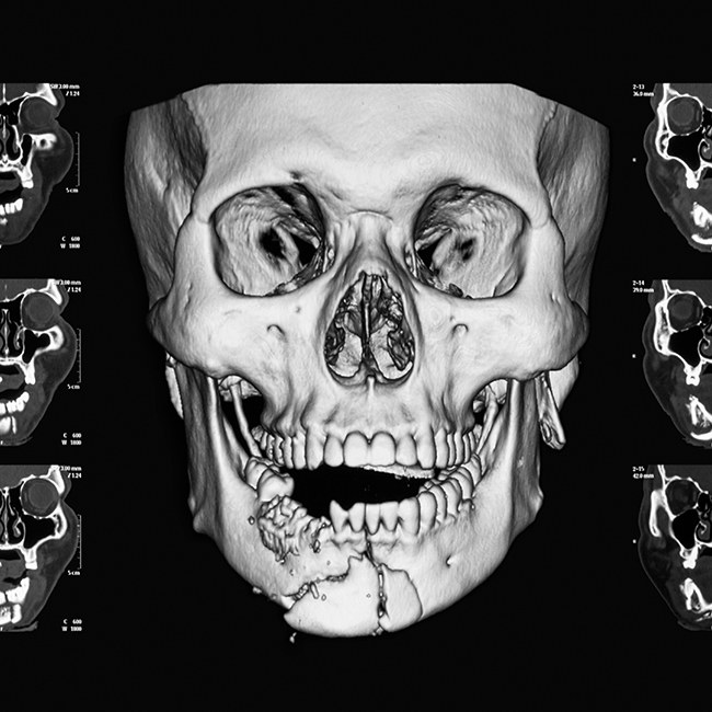 X-ray ofpatient in need of facial trauma treatment