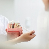 Dental team member explaining how dental implants work in Houston