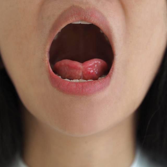 Closeup of woman with cigarette and a high risk of oral cancer in Houston