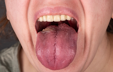 Close up of a person sticking out their tongue