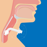 Animated person with tracheostomy