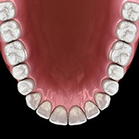 Animated smile after lower jaw surgery