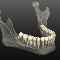 Upper jaw after surgery