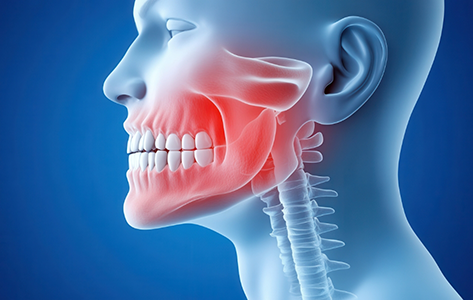 Illustrated x ray of a person's teeth and jaws