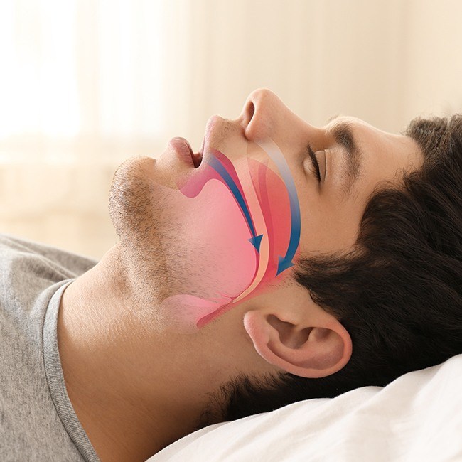 Sleeping man with animated airway over profile