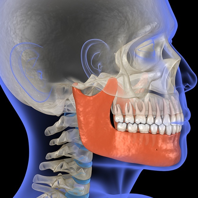 3 d rendering of skull and jaw before T M J treatment