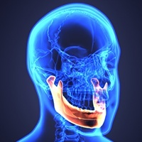 Animated open joint reconstructive surgery plan