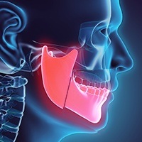 Animated jaw in need of condylotomy
