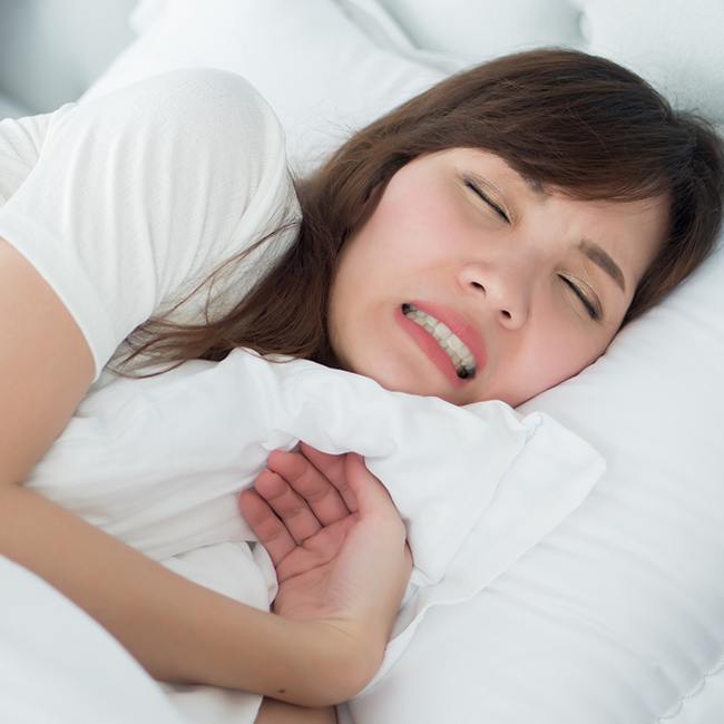 Woman grinding teeth in her sleep causing T M J disorders