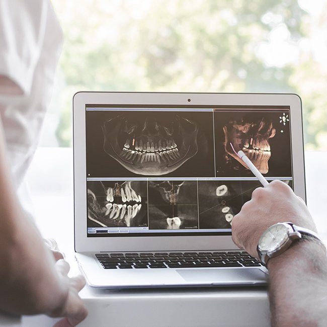 Digital impressions and x-rays used for T M J diagnosis