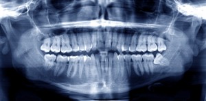 jaw surgery can correct many problems.