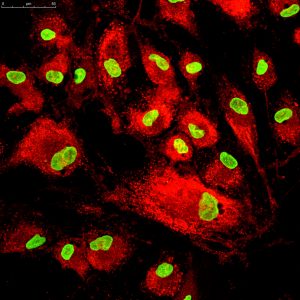 tmj treatment with stem cell manipulation