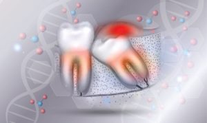 Wisdom teeth illustration with DNA molecules in background