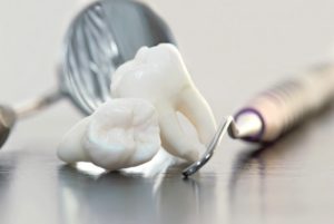 Extracted wisdom teeth on table next to dental instrument