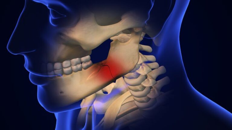 How Do Oral Surgeons Treat Facial Trauma? - Piney Point OMS Houston