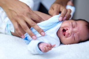 Crying baby with a cleft lip 